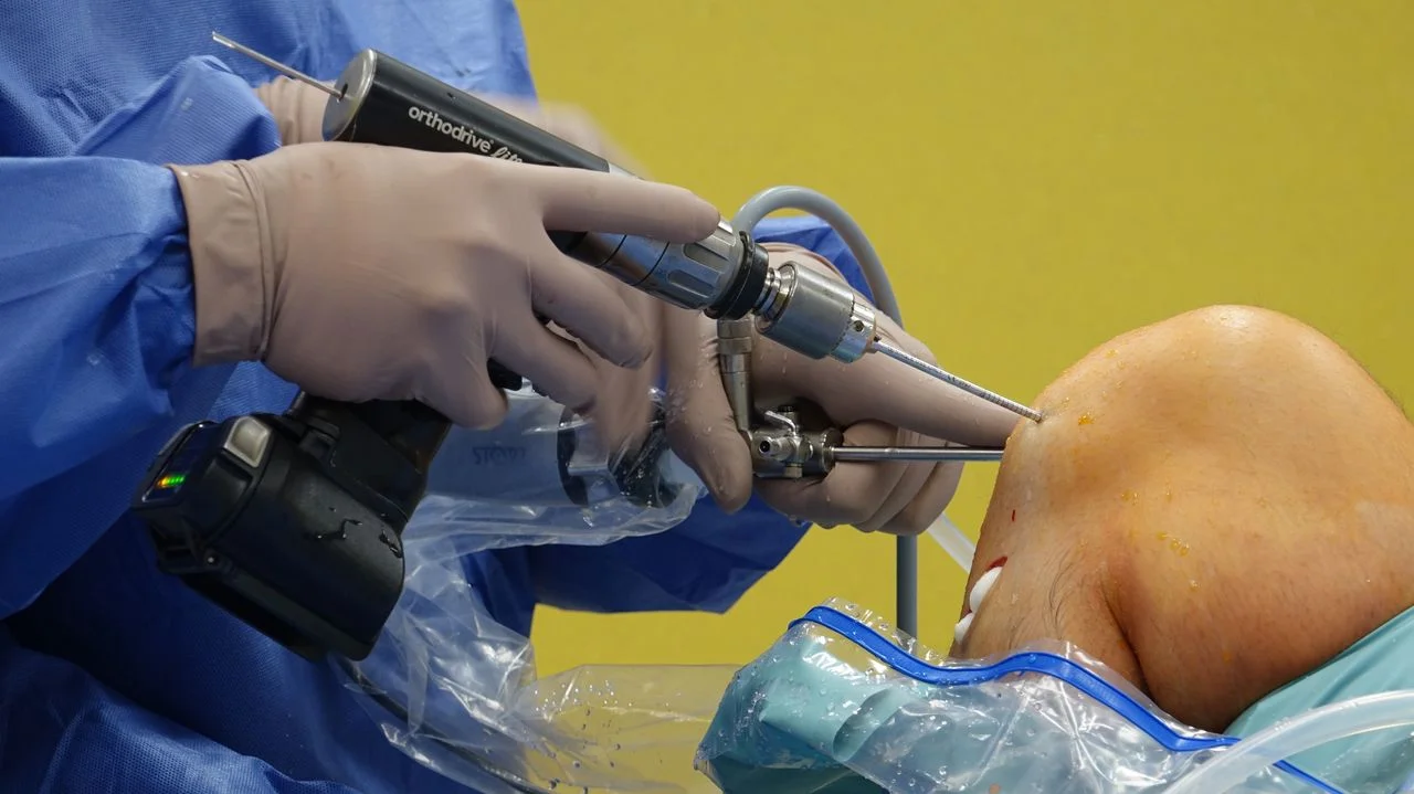 joint replacement